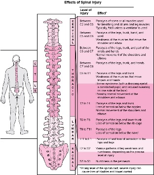 Enfermidades no corpo asociadas a danos en varias partes da columna vertebral