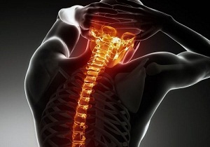 Regras para o tratamento da osteocondrose da columna cervical