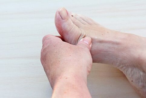 Artrose do pé