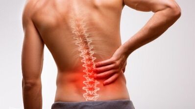 Signos e síntomas dunha osteocondrose da columna lumbar